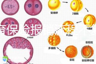 生育保險報銷流程不復(fù)雜,辦理地點(diǎn)不分地域異地可報銷