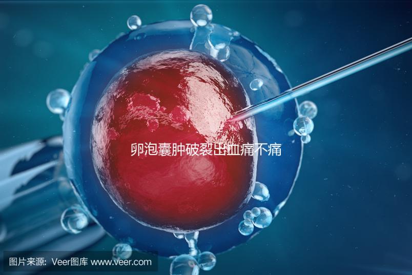 卵泡囊腫破裂出血痛不痛？經(jīng)歷過的姐妹們給出回應