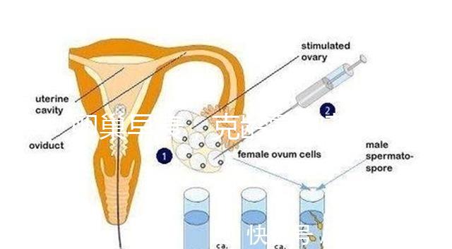卵巢早衰,克齡蒙和芬嗎通藥物選擇引爭(zhēng)議