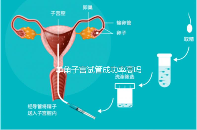單角子宮試管成功率高嗎？送你5招降低胚胎著床的難度