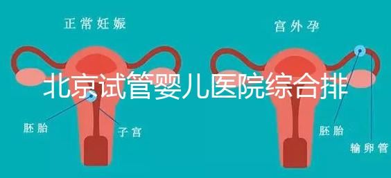 北京試管嬰兒醫(yī)院綜合排名比較完美的有哪幾個