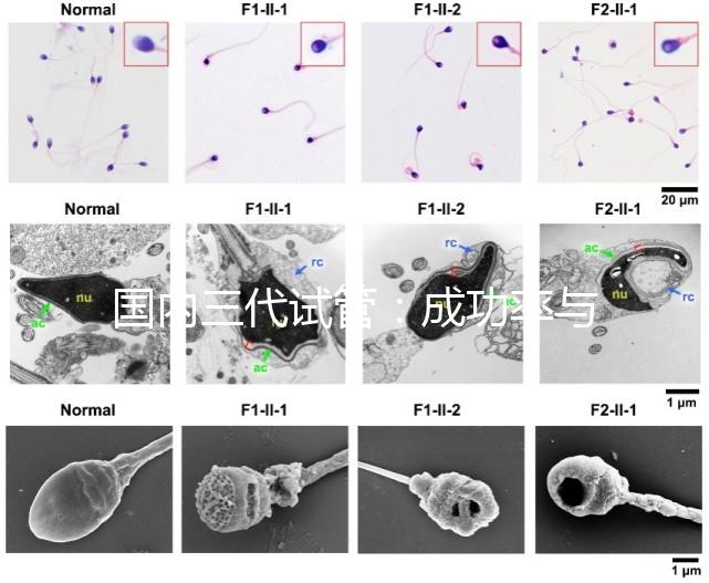 國內(nèi)三代試管：成功率與費(fèi)用全知曉？