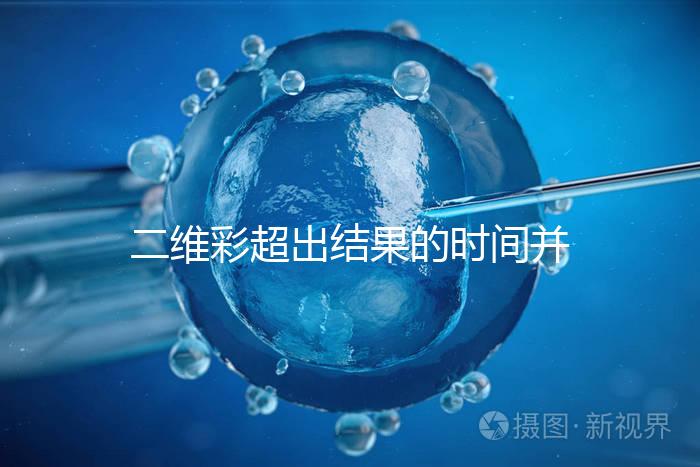 二維彩超出結果的時間并不長，從檢查流程便可看出