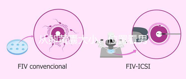 從卵黃囊大小、位置看男女,寶寶性別分辨一眼就準