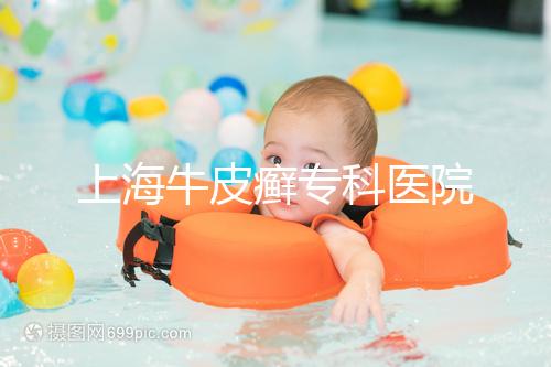 上海牛皮癬專科醫院