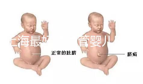 上海最好的試管嬰兒醫(yī)院信息匯總，想要最權(quán)威真得看這幾家