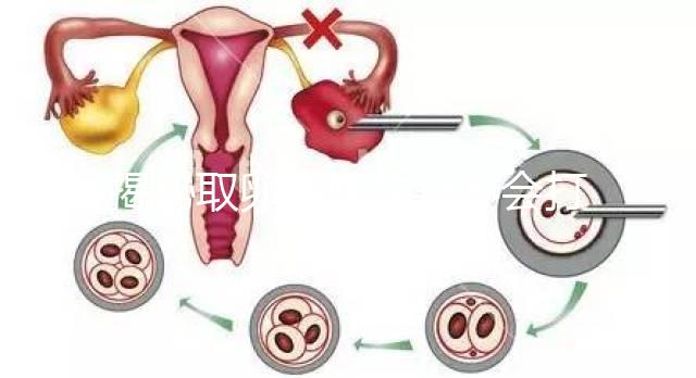 揭秘取卵后醫生會不會打電話問選幾代?這些問題會涉及到