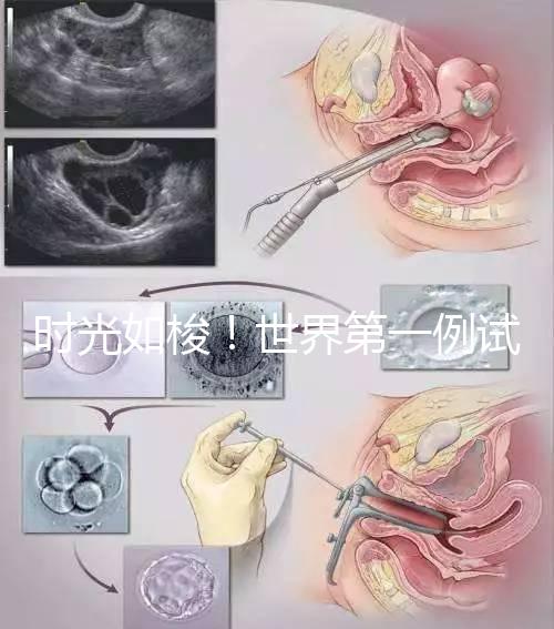 時光如梭!世界第一例試管嬰兒路易絲·布朗已經(jīng)41歲啦