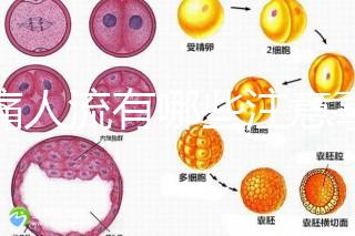 無痛人流有哪些注意事項?