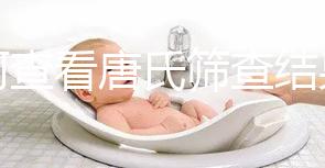 如何查看唐氏篩查結果，珠海醫院價格二百四起