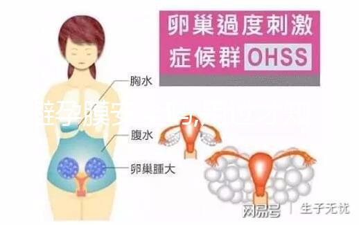 避孕膜安全嗎,用過(guò)才知道3點(diǎn)注意事項(xiàng)