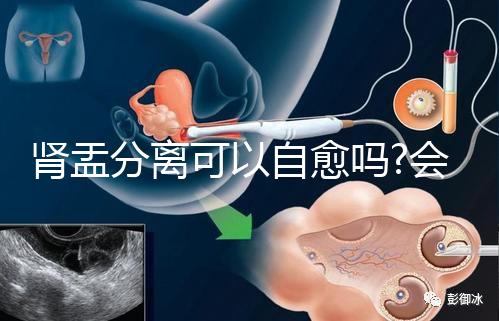 腎盂分離可以自愈嗎?會(huì)不會(huì)自己好要看造成的病因