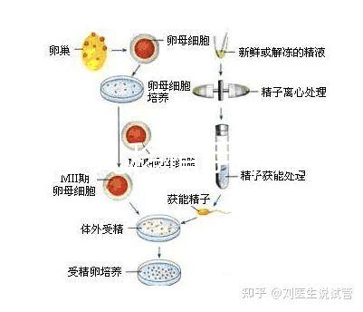 試管嬰兒移植手術(shù)疼嗎（試管失敗第二次收費(fèi)嗎）