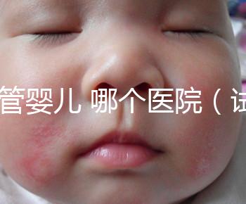 試管嬰兒 哪個醫院（試管嬰兒哪個醫院做的最好）