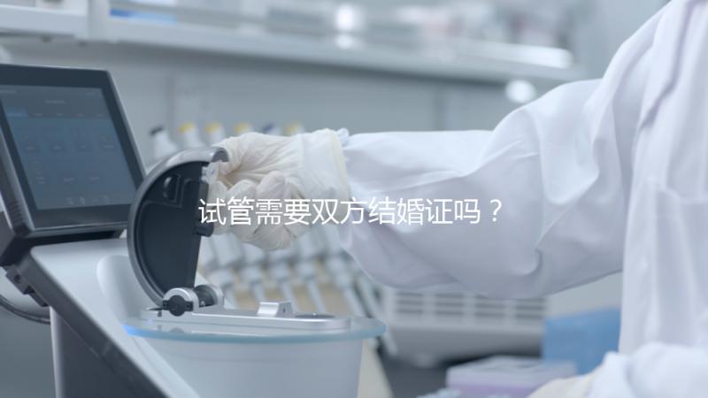試管需要雙方結婚證嗎？試管是不是需要結婚證