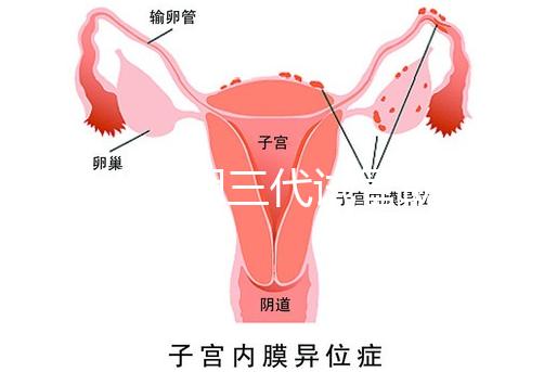 2025昆明三代試管助孕機構收費明細，價格8萬至15萬不等