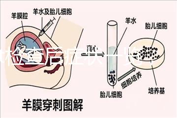 tct檢查后癥狀一覽,專家提醒做好處理措施是關鍵